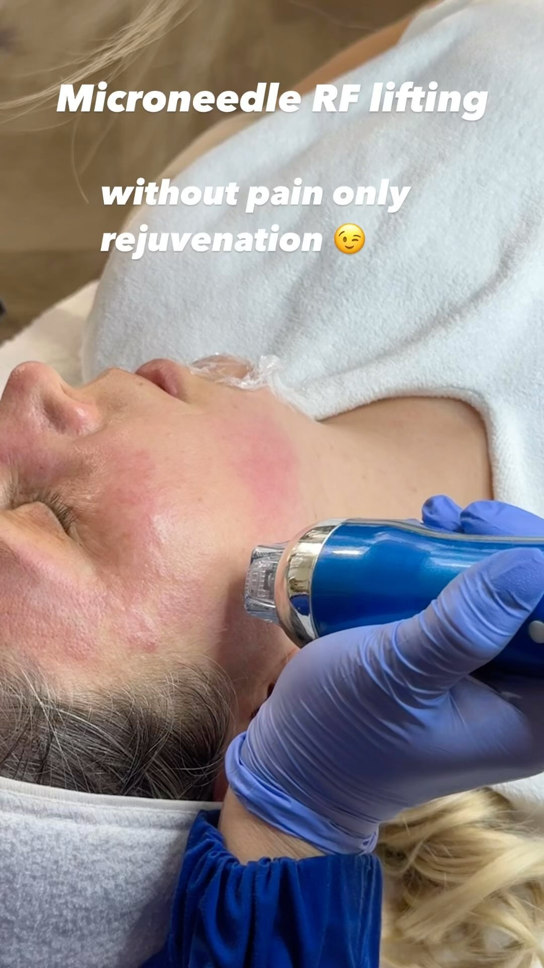 Anti-age процедури у Vira Beauty Studio