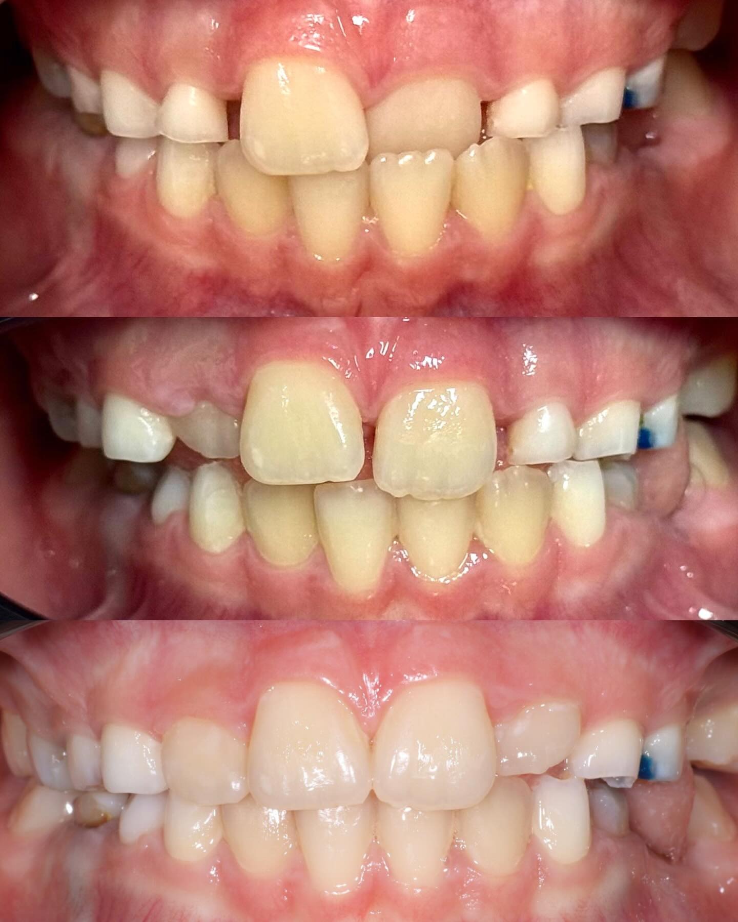 Orthodontics Netherlands українською